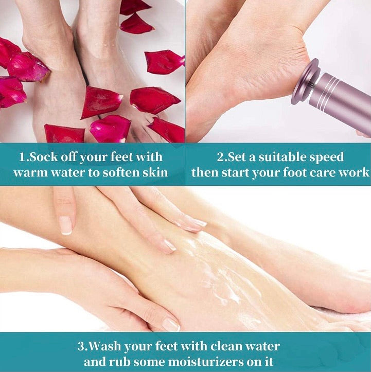 Electric Foot Callus Remover